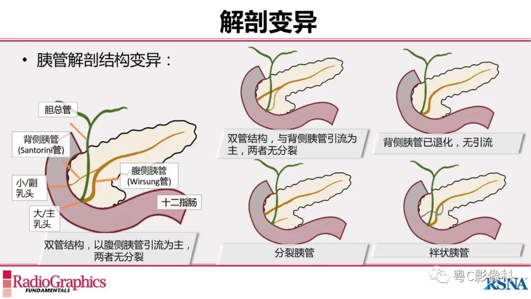 影像PPT - 【PPT】MRCP：放射医师必知-15