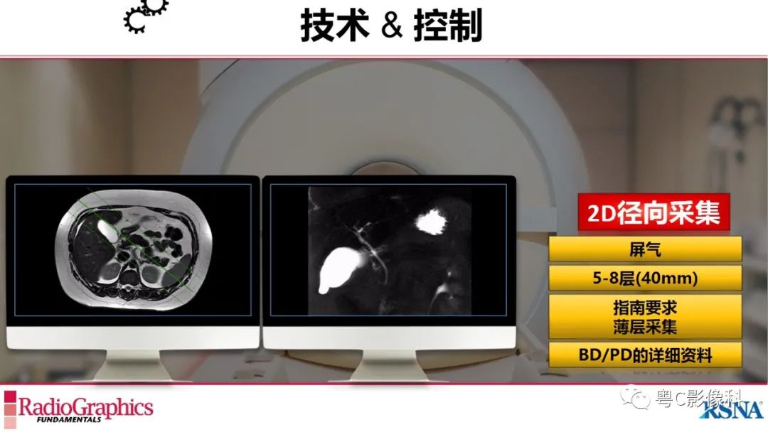影像PPT - 【PPT】MRCP：放射医师必知-20