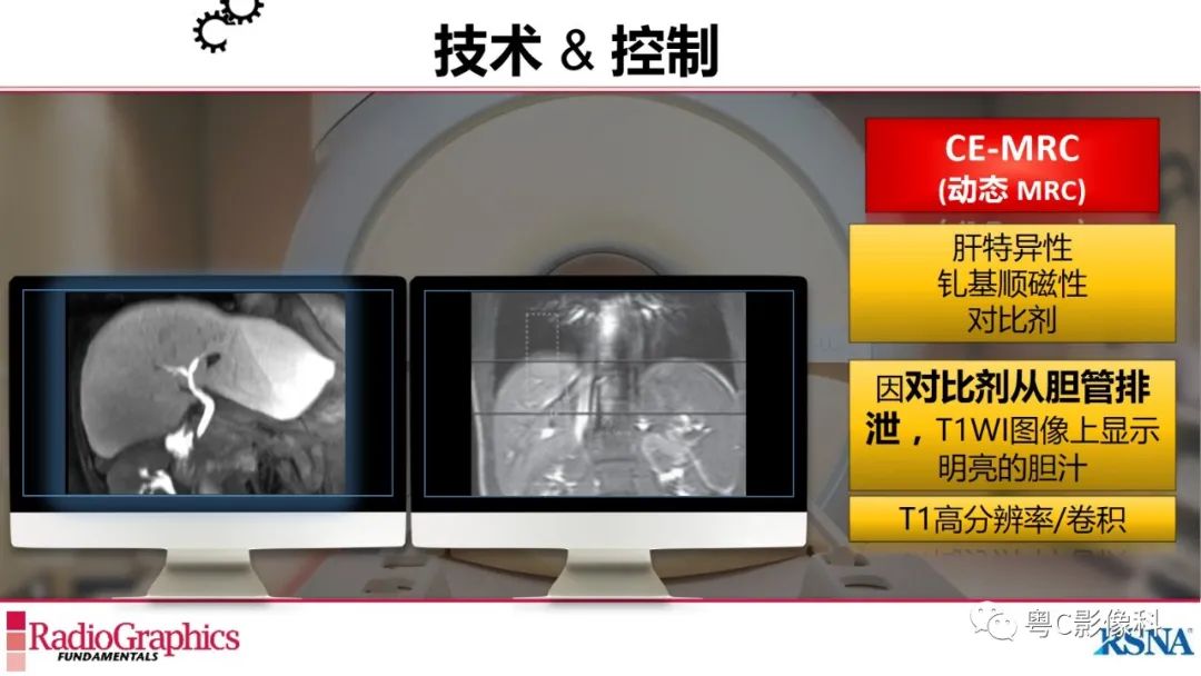 影像PPT - 【PPT】MRCP：放射医师必知-22
