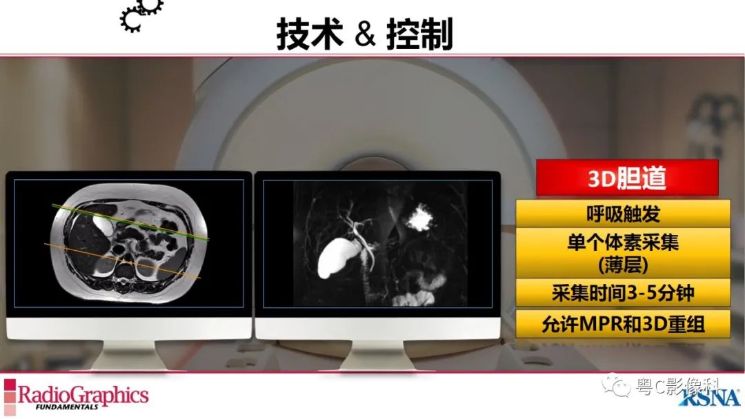 影像PPT - 【PPT】MRCP：放射医师必知-21