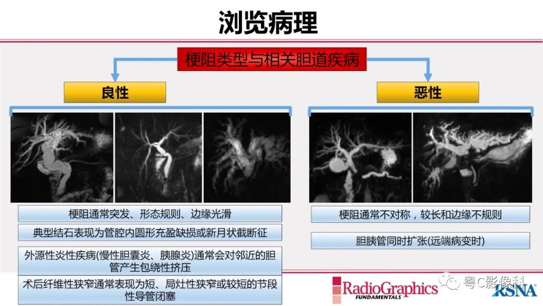 影像PPT - 【PPT】MRCP：放射医师必知-24