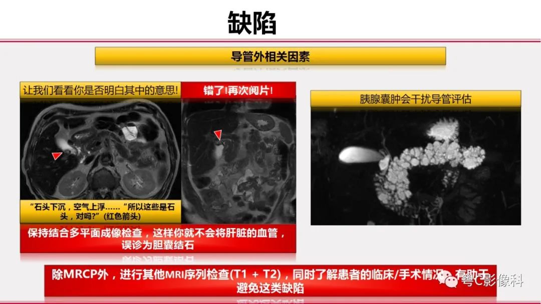 影像PPT - 【PPT】MRCP：放射医师必知-45
