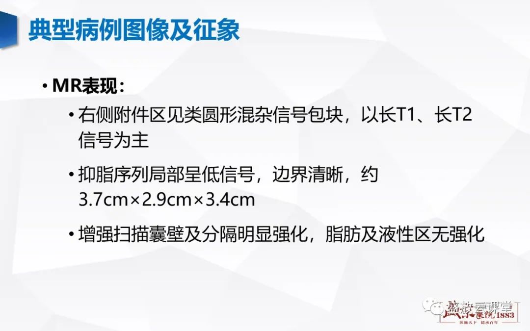 影像PPT - 【PPT】卵巢肿瘤-5