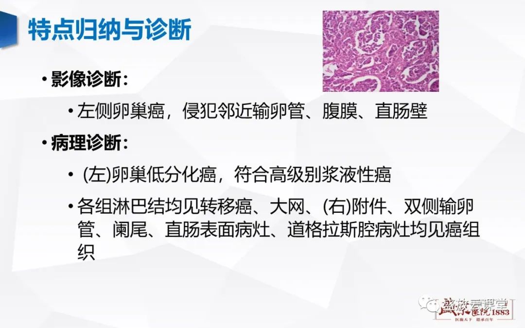 影像PPT - 【PPT】卵巢肿瘤-14