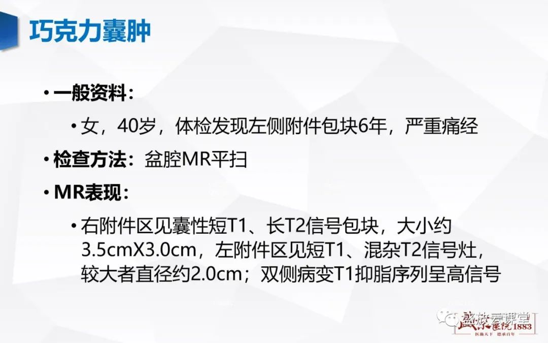 影像PPT - 【PPT】卵巢肿瘤-17