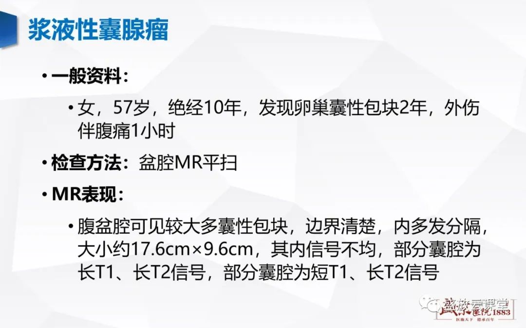 影像PPT - 【PPT】卵巢肿瘤-20