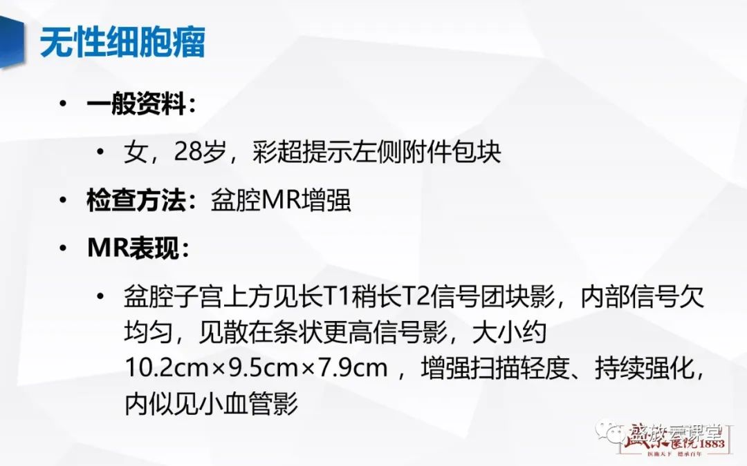 影像PPT - 【PPT】卵巢肿瘤-26