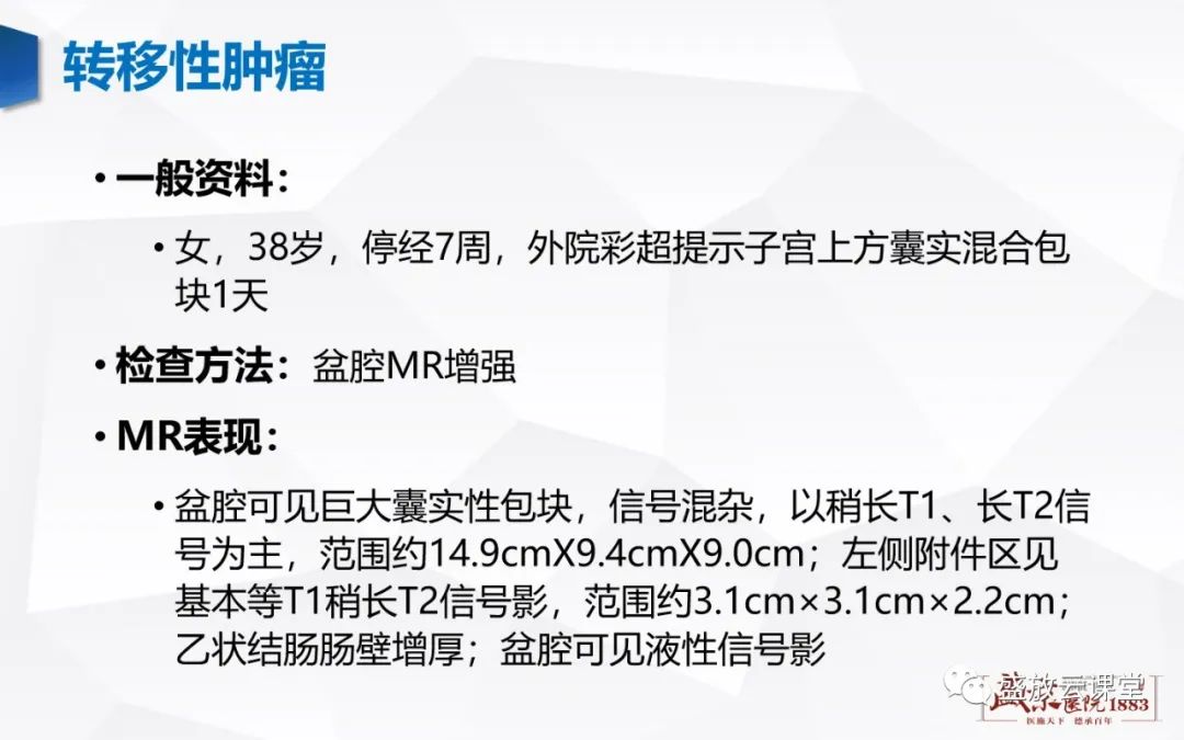影像PPT - 【PPT】卵巢肿瘤-29