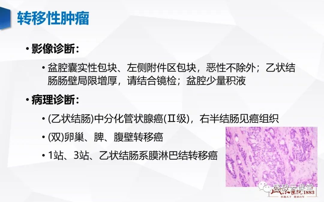影像PPT - 【PPT】卵巢肿瘤-31