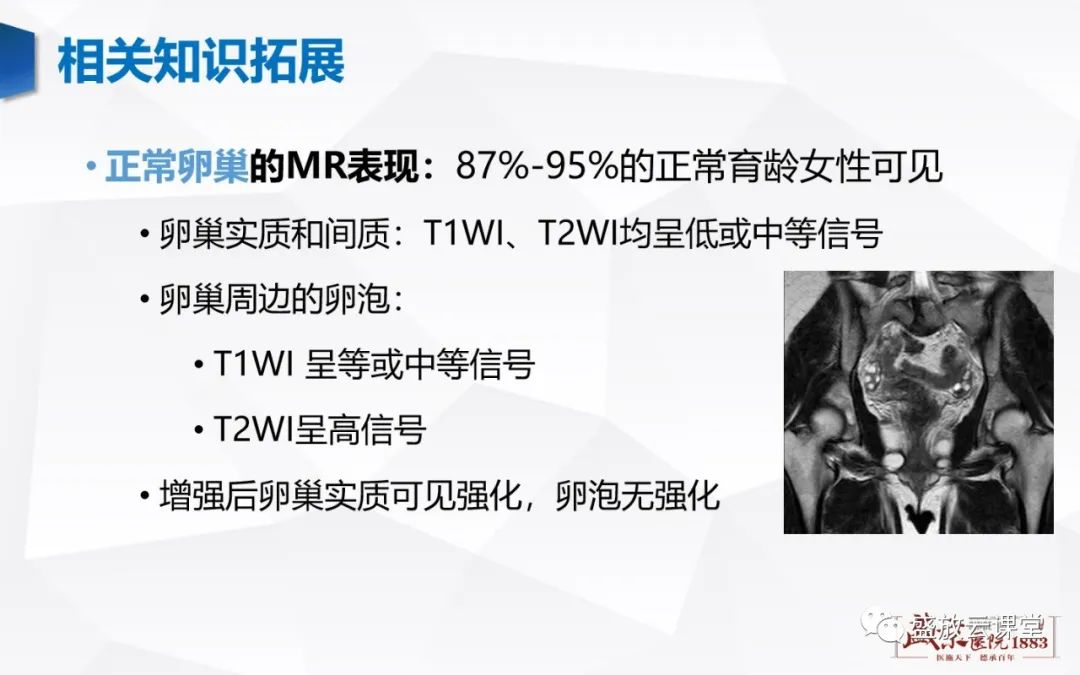 影像PPT - 【PPT】卵巢肿瘤-34