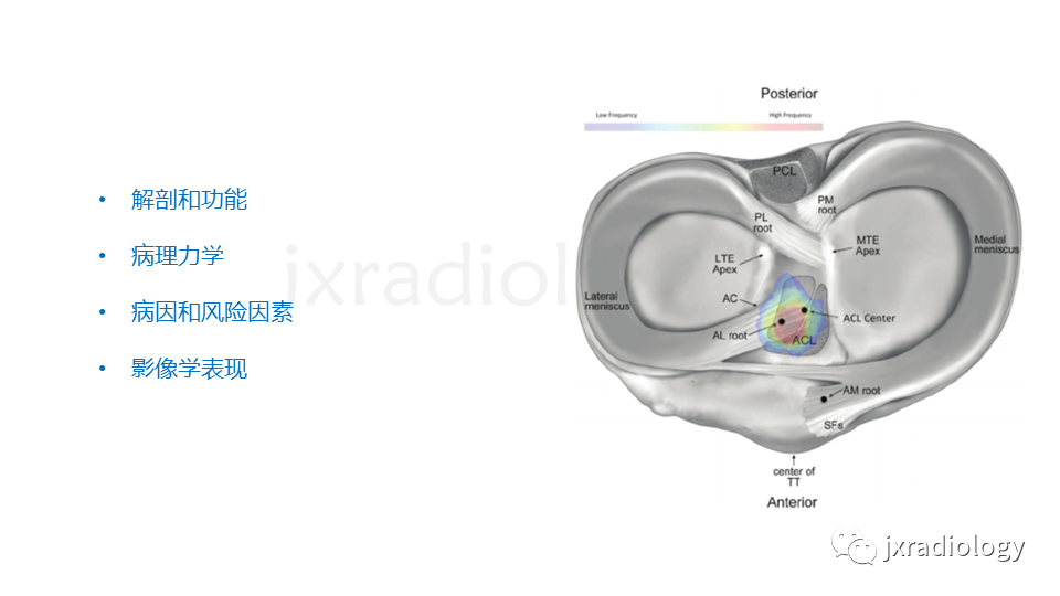 影像PPT - 【PPT】半月板根部撕裂-5