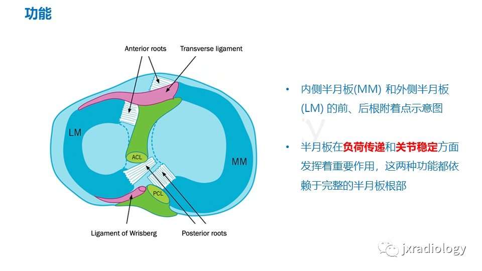 影像PPT - 【PPT】半月板根部撕裂-11