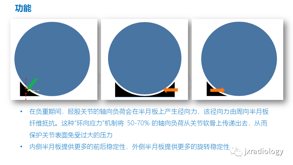 影像PPT - 【PPT】半月板根部撕裂-12