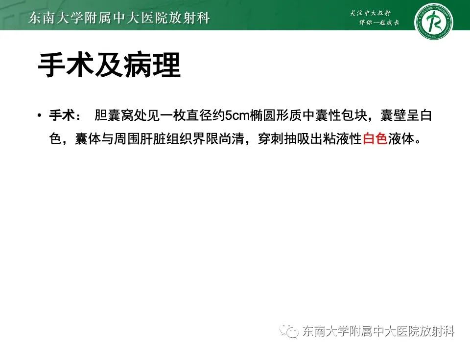 影像PPT - 【PPT】黏液性囊性肝胆肿瘤-4 影像PPT - 【PPT】黏液性囊性肝胆肿瘤-4