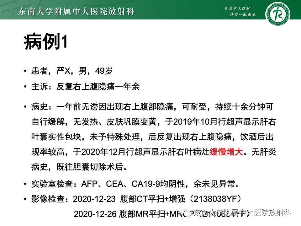 影像PPT - 【PPT】黏液性囊性肝胆肿瘤-3 影像PPT - 【PPT】黏液性囊性肝胆肿瘤-3