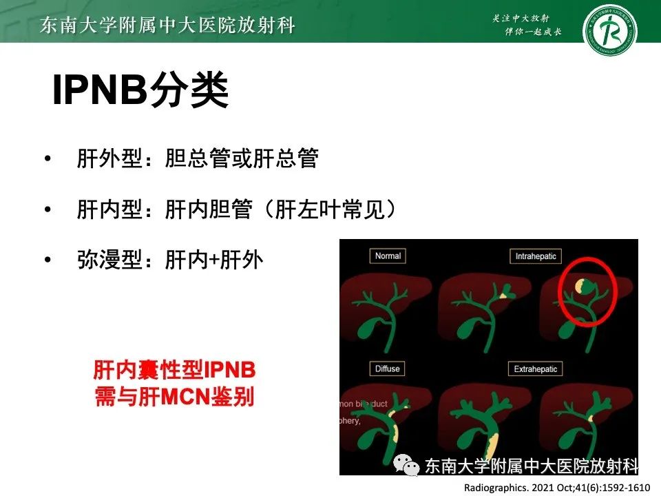 影像PPT - 【PPT】黏液性囊性肝胆肿瘤-21 影像PPT - 【PPT】黏液性囊性肝胆肿瘤-21