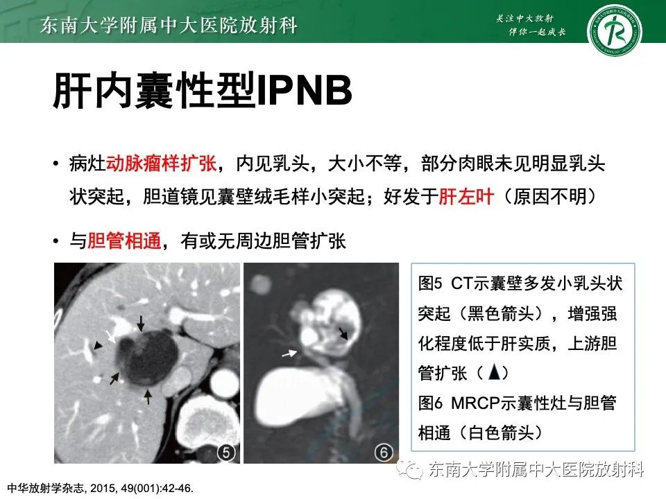 影像PPT - 【PPT】黏液性囊性肝胆肿瘤-22 影像PPT - 【PPT】黏液性囊性肝胆肿瘤-22