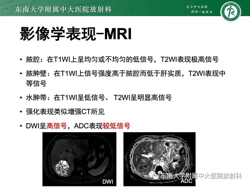 影像PPT - 【PPT】黏液性囊性肝胆肿瘤-32 影像PPT - 【PPT】黏液性囊性肝胆肿瘤-32