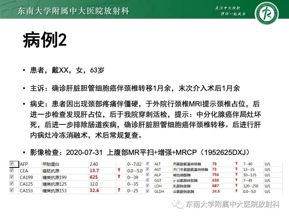 影像PPT - 【PPT】黏液性囊性肝胆肿瘤-37 影像PPT - 【PPT】黏液性囊性肝胆肿瘤-37