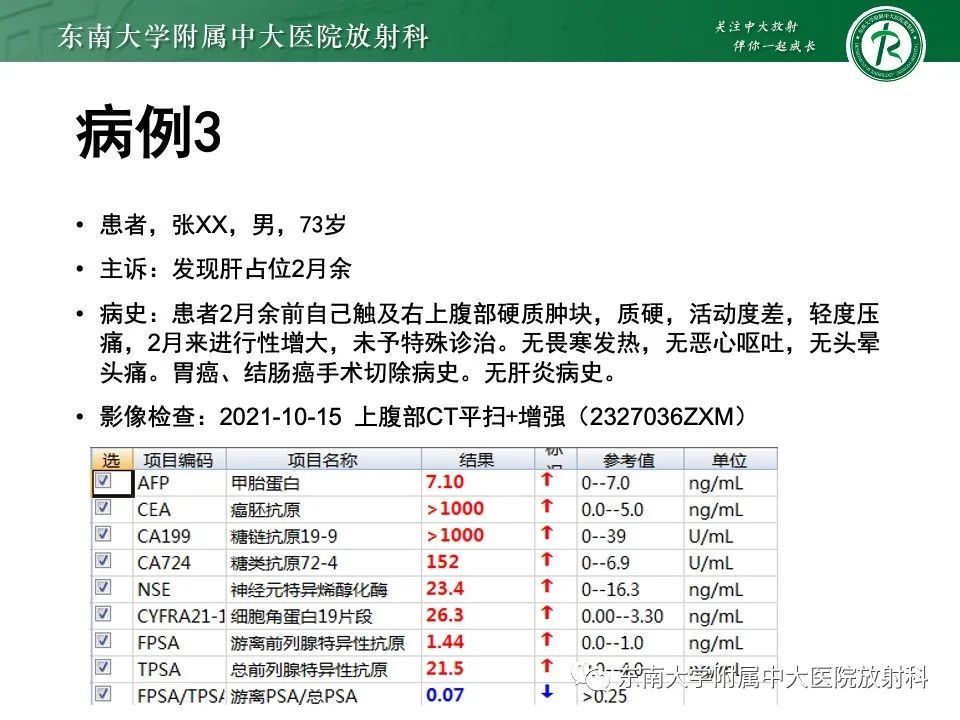 影像PPT - 【PPT】黏液性囊性肝胆肿瘤-42 影像PPT - 【PPT】黏液性囊性肝胆肿瘤-42