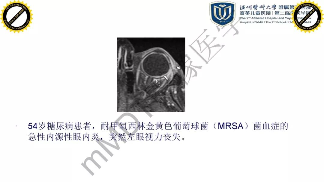 影像PPT - 【PPT】眼眶急诊的影像表现-15