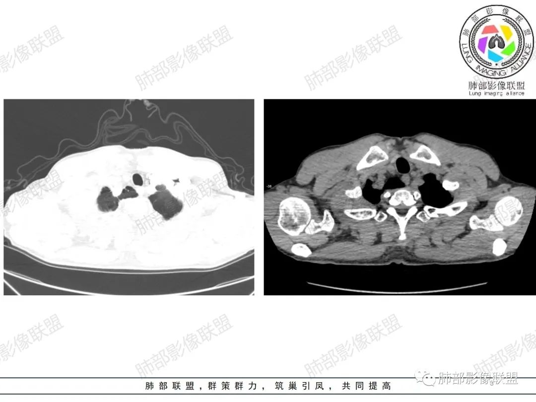 影像PPT - 【病例】纠结定位的恶性肿瘤-3 影像PPT - 【病例】纠结定位的恶性肿瘤-3