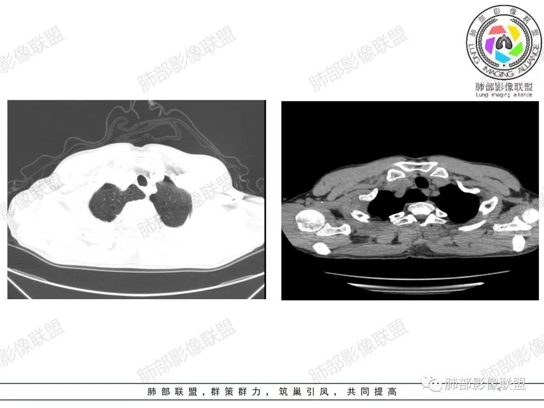 影像PPT - 【病例】纠结定位的恶性肿瘤-4 影像PPT - 【病例】纠结定位的恶性肿瘤-4