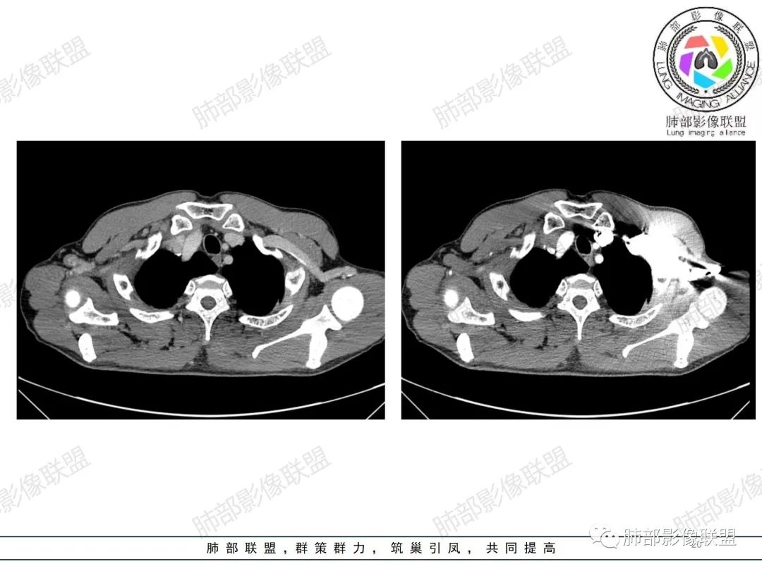 影像PPT - 【病例】纠结定位的恶性肿瘤-20 影像PPT - 【病例】纠结定位的恶性肿瘤-20