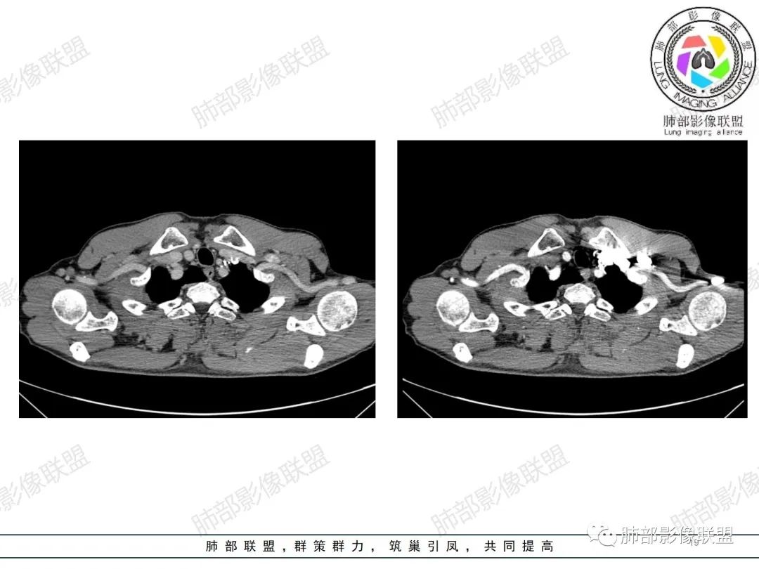 影像PPT - 【病例】纠结定位的恶性肿瘤-19 影像PPT - 【病例】纠结定位的恶性肿瘤-19