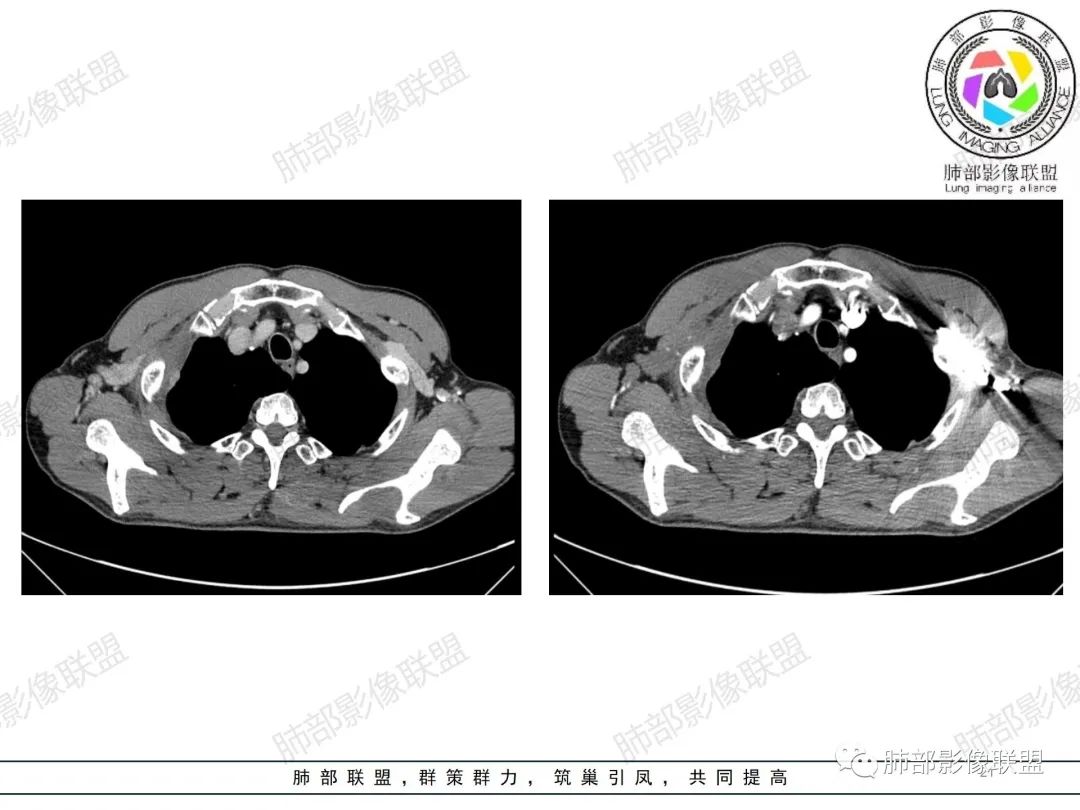 影像PPT - 【病例】纠结定位的恶性肿瘤-21 影像PPT - 【病例】纠结定位的恶性肿瘤-21