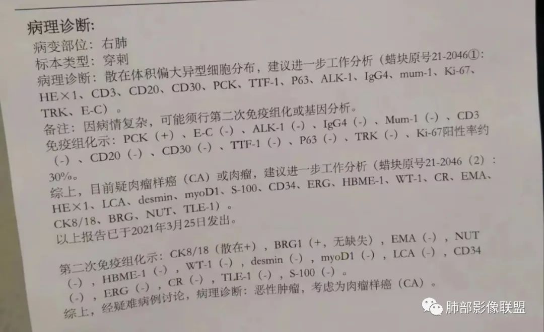 影像PPT - 【病例】纠结定位的恶性肿瘤-36 影像PPT - 【病例】纠结定位的恶性肿瘤-36