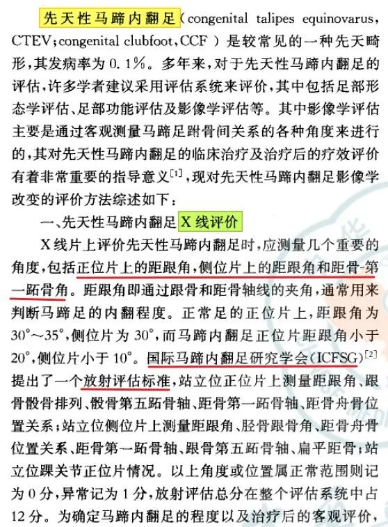 影像PPT - 【病例】先天性马蹄内翻足1例X线-9 影像PPT - 【病例】先天性马蹄内翻足1例X线-9