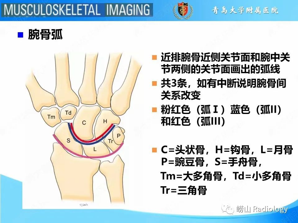影像PPT - 【PPT】月骨脱位-4