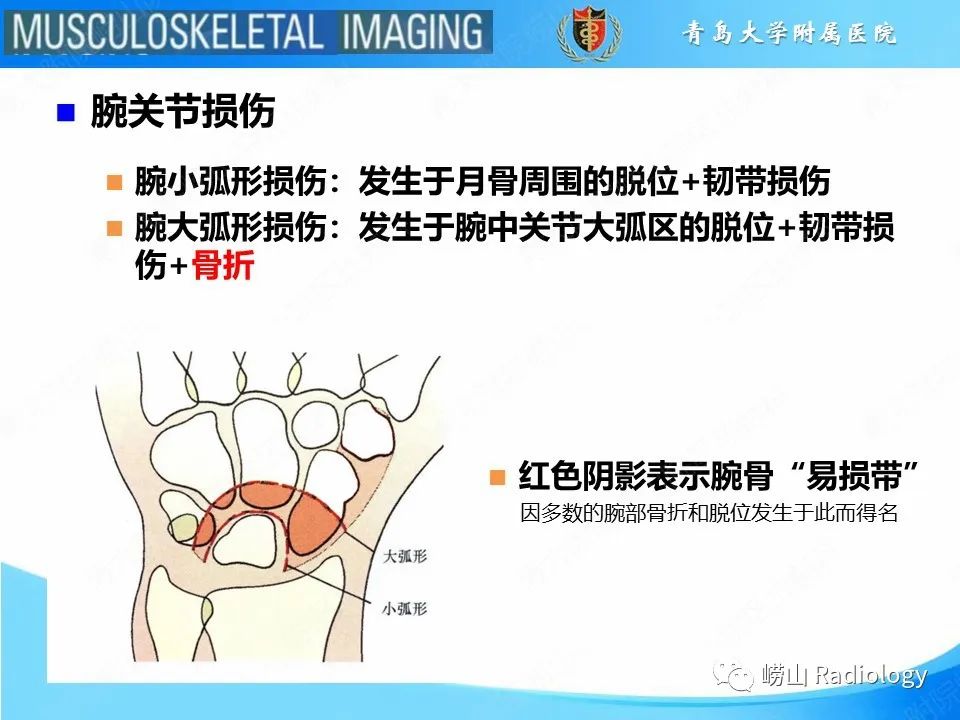 影像PPT - 【PPT】月骨脱位-6
