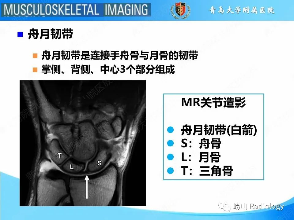 影像PPT - 【PPT】月骨脱位-7