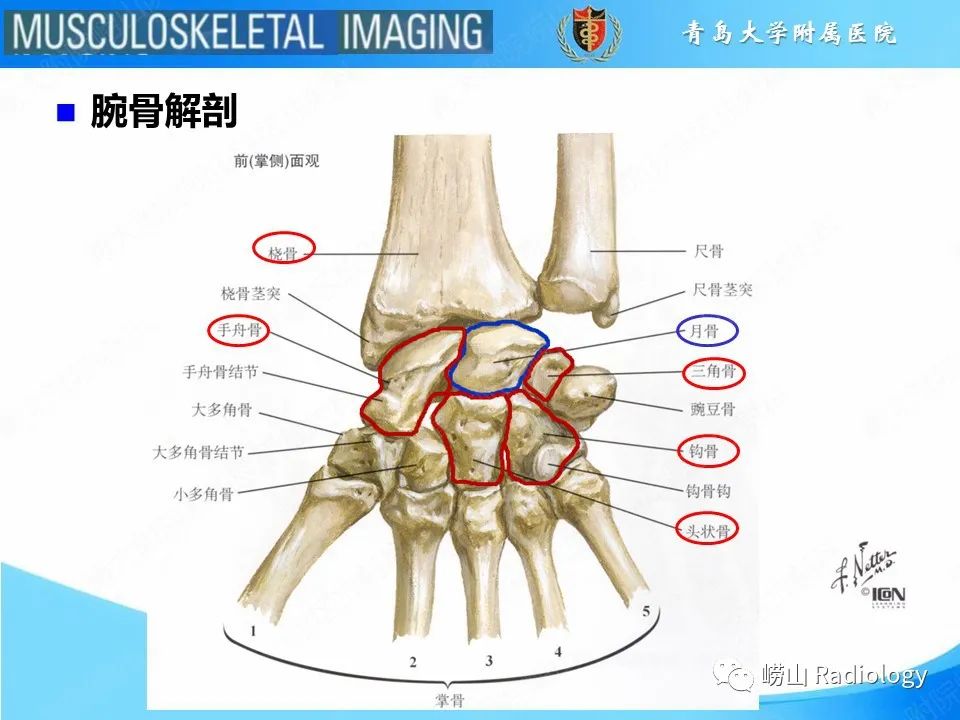 影像PPT - 【PPT】月骨脱位-3