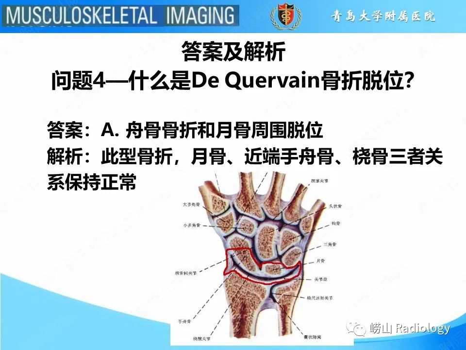 影像PPT - 【PPT】月骨脱位-23