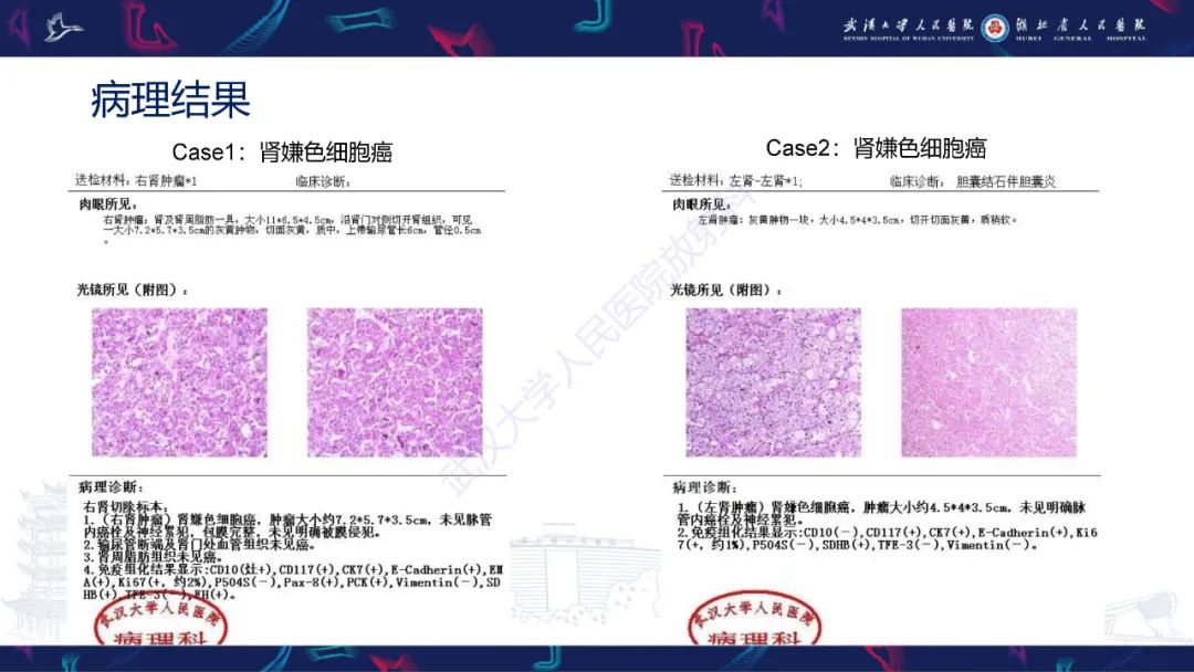 影像PPT - 【PPT】肾嫌色细胞癌影像诊断-7