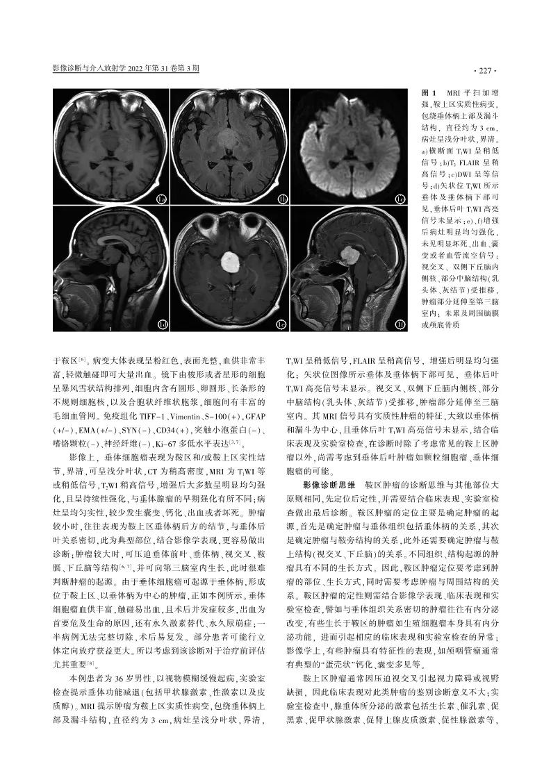 影像PPT - 【病例】垂体细胞瘤1例MR影像诊断思维-14