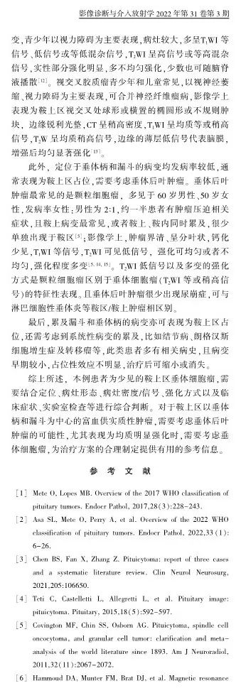 影像PPT - 【病例】垂体细胞瘤1例MR影像诊断思维-10