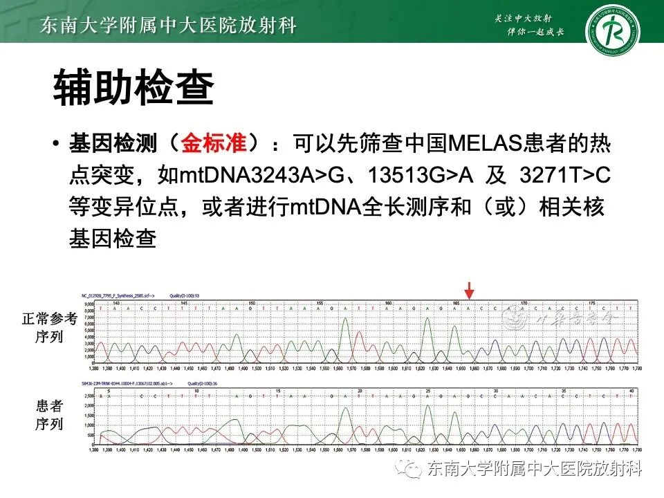 影像PPT - 【PPT】线粒体脑肌病伴高乳酸血症和卒中样发作-15