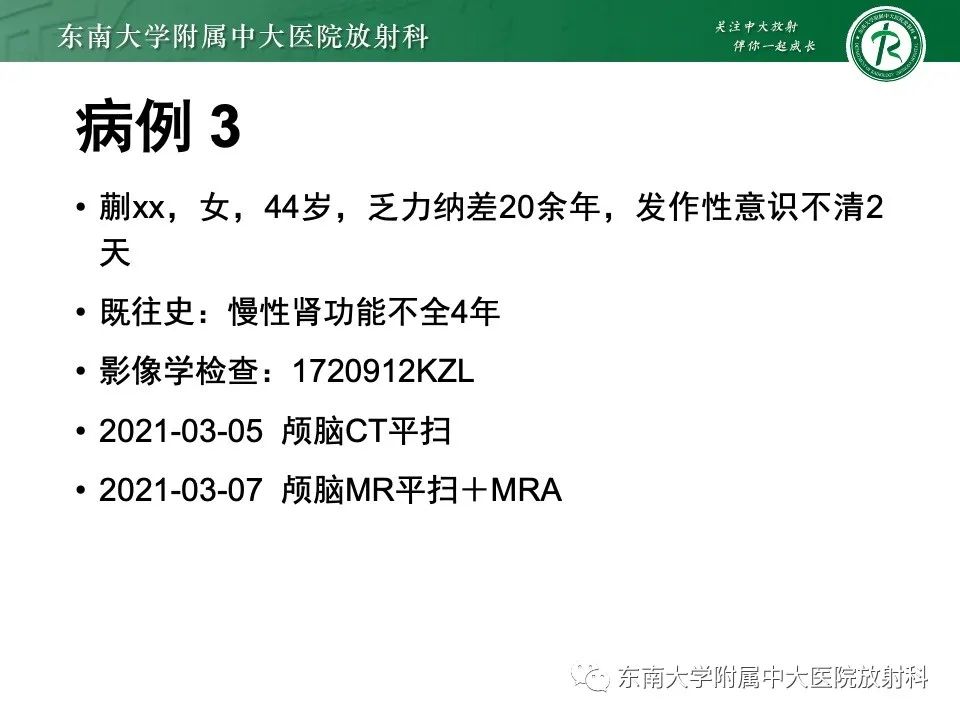 影像PPT - 【PPT】线粒体脑肌病伴高乳酸血症和卒中样发作-40