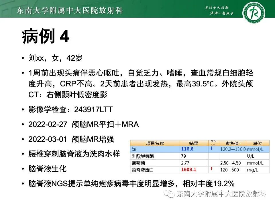 影像PPT - 【PPT】线粒体脑肌病伴高乳酸血症和卒中样发作-44