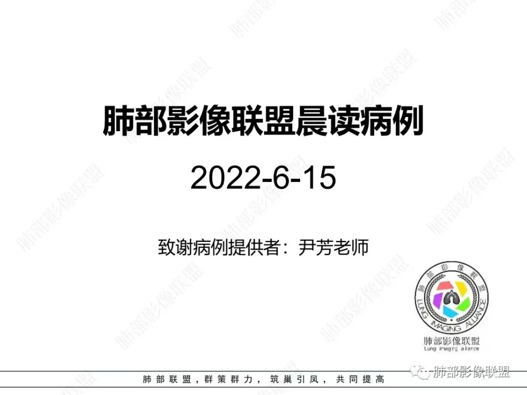 影像PPT - 【病例】左上胸骨外尤文氏肉瘤1例CT影像-1 影像PPT - 【病例】左上胸骨外尤文氏肉瘤1例CT影像-1