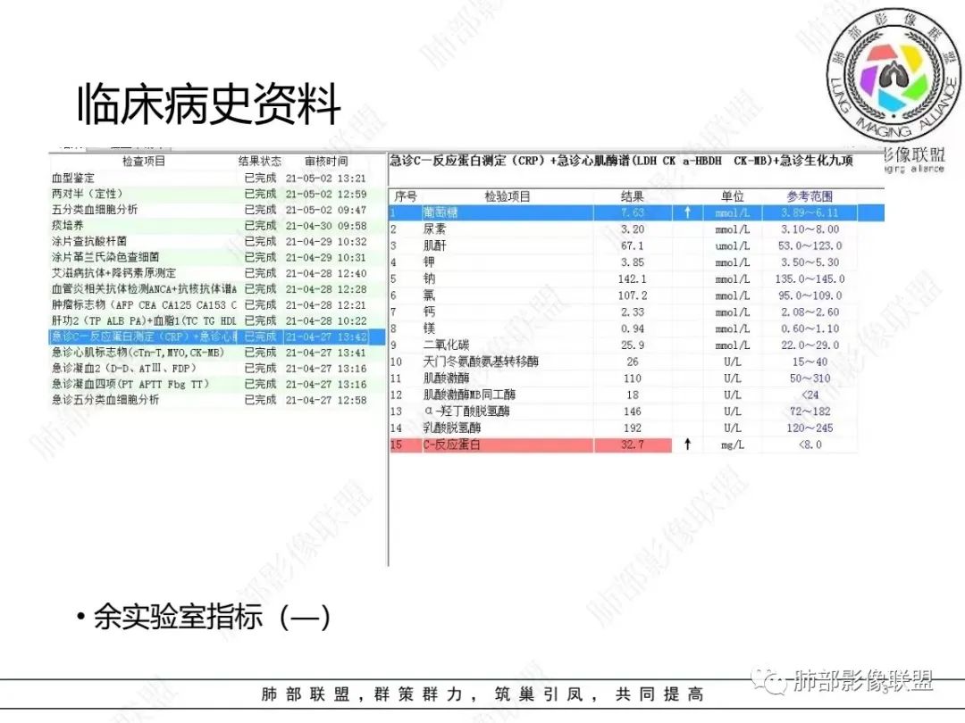 影像PPT - 【病例】左上胸骨外尤文氏肉瘤1例CT影像-3 影像PPT - 【病例】左上胸骨外尤文氏肉瘤1例CT影像-3