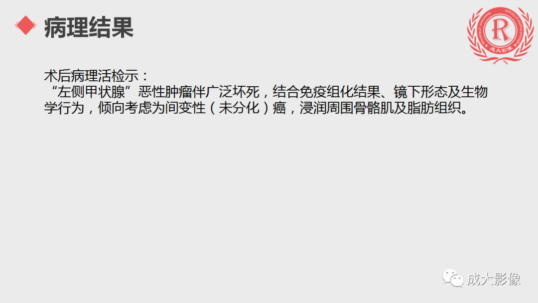 影像PPT - 【PPT】甲状腺癌影像学表现-3