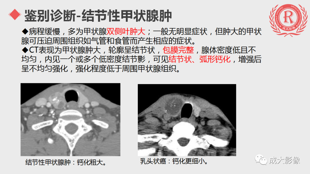 影像PPT - 【PPT】甲状腺癌影像学表现-16