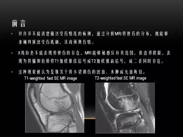 影像PPT - 【PPT】膝关节骨挫伤的分类及MRI表现特点-3