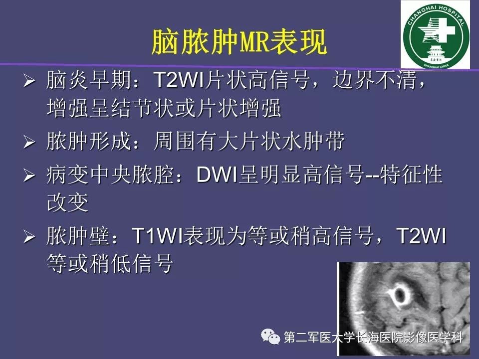 影像PPT - 【PPT】脑内常见环形强化病变的鉴别诊断-22