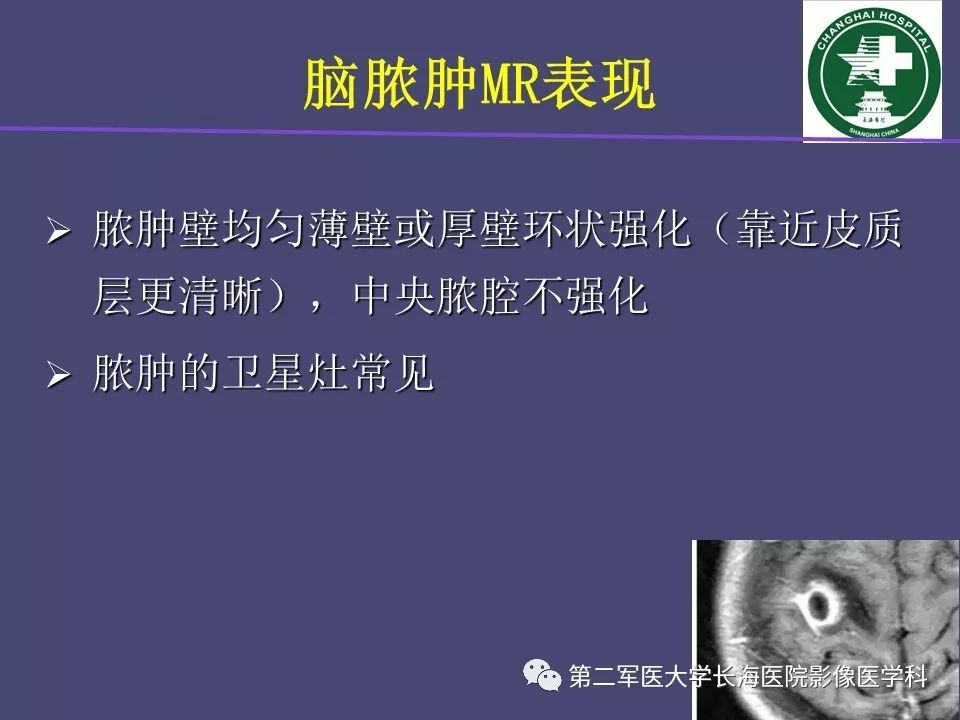 影像PPT - 【PPT】脑内常见环形强化病变的鉴别诊断-23